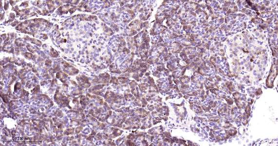 人环氧合酶2即用型免疫组化试剂盒-IHC0408H